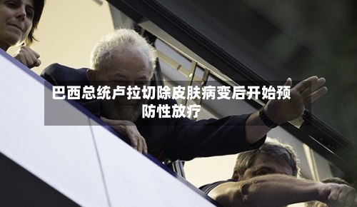 巴西总统卢拉切除皮肤病变后开始预防性放疗